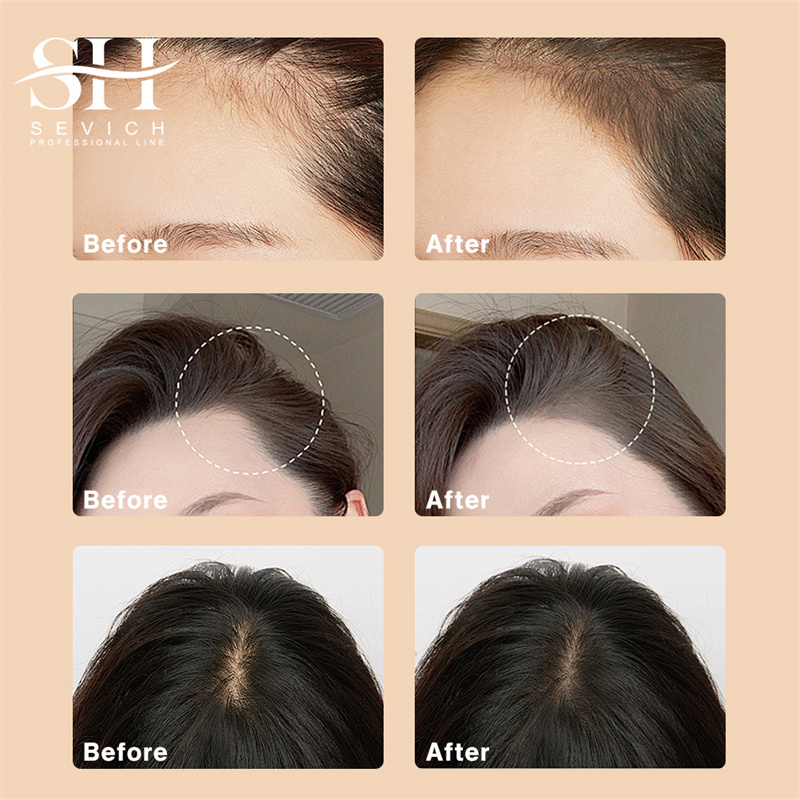 Hairline Shadow Powder Black R - đánh giá và giá Rooting Hormone Powder